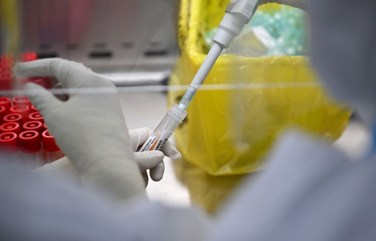A technician works at a nucleic acid testing laboratory.