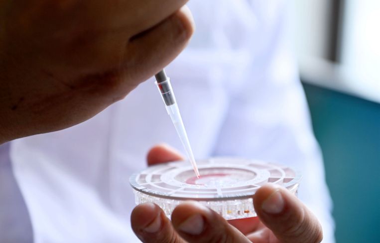 A laboratory technician checks blood samples.