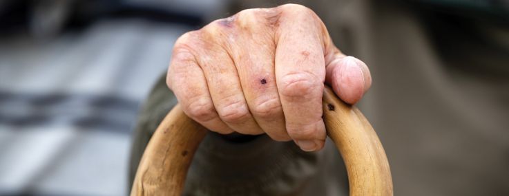 A close-up of a hand on a cane.