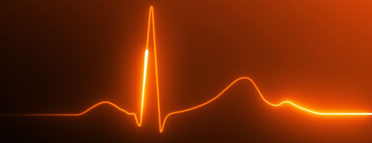 An illustration of a heart-rate monitor.